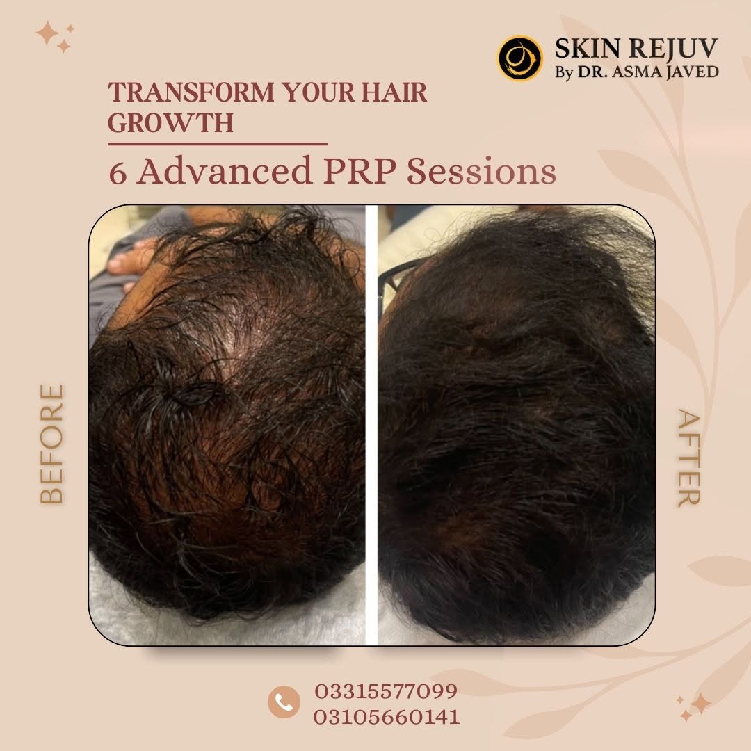 Before After Treatment 3